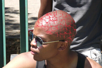 Paulingitis, 33 Bloemfontein, Free State, South Africa